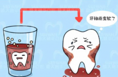 准妈妈必读：孕期口腔保健手册，轻松解决‘可乐牙’问题！