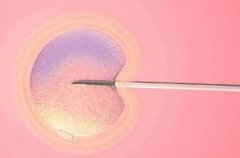 单身人士可选择的国家有哪些？内附海外试管热门原因！