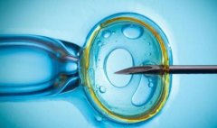 多囊卵巢综合征患者，真的适合微刺激方案?