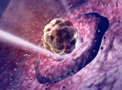 做完胚胎移植怎么知道有没有怀上，胚胎着床自己有感觉吗？