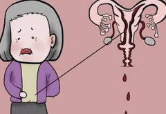 绝经症状是什么？绝经后有什么坏处？