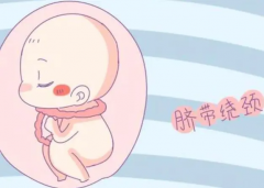 全孕期脐带问题大揭秘！早知早防，宝宝更健康！