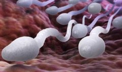 21三体综合征是因什么原因造成的？需要注意什么？