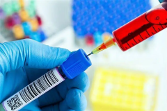 做试管为什么要查血型，血型不合有什么影响？