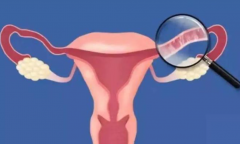 输卵管堵塞到底是怎么引起的,可能是这几个原因你知道吗?