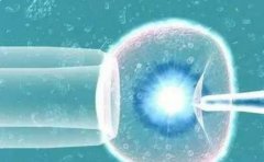 试管为什么会多次失败？什么原因导致的？