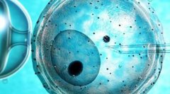 在柬埔寨做试管需要多长时间？