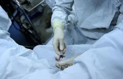 取卵后出现胸水怎么办？及时采取措施身体才不会手影响