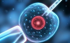 赴柬试管全攻略