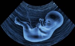 陕西试管医院有哪些?选择起来大有＂奥秘＂!