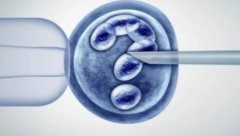 去格鲁吉亚做试管有这些优势，政策宽松是首要原因