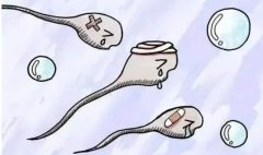 精子异常有哪些情况？多重异常指数MAI不做单独分析