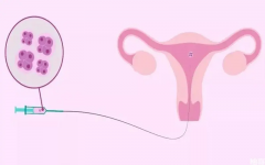 做完鲜胚移植什么时候才会着床？了解清楚对受孕有帮助