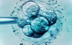 天津西青区有能做试管的吗?