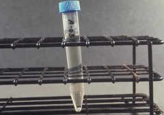 阿拉善盟额济纳旗医学发达吗?可以做试管吗?