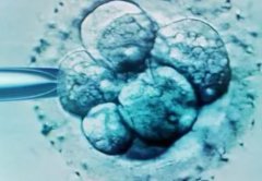 丽江华坪县哪里的试管技术先进？