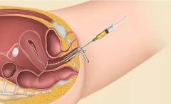 揭秘！试管宝宝“种子”收集后，七大恢复秘籍助你火速回归巅峰状态
