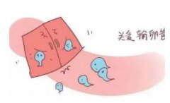 输卵管炎或导致癌变，可以用这些方法预防