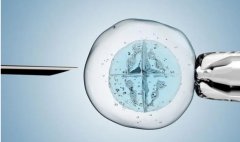 取卵个数影响试管成功吗？取卵手术一般用这两种方法