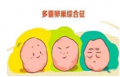 多囊卵泡导症状不明显，需要治疗吗？