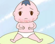 火棉胶婴儿是什么？对于婴儿的发育什么帮助？