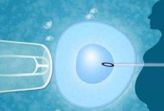 第三代试管有社么优点?它是如何降低胎儿畸形率的