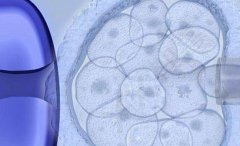 为什么一些试管未足月提前人工介入破水，这样做的原因是什么