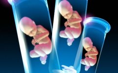 做试管可以任选男女?专家告诉你答案!