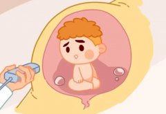 胚胎质量不佳会停胎吗?怎样预防胚胎质量不好引起的停胎?