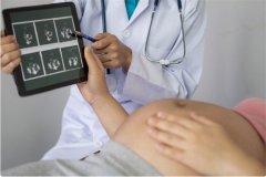 拮抗剂的方案的原理是什么？有什么优势吗？