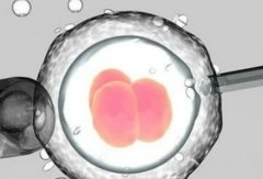 注意！试管技术在日本不能用于性别选择