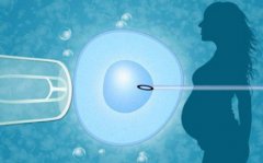 柬埔寨试管生女儿的总体价格多少？有额外费用吗？