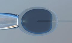 卵泡大是什么原因造成的？卵泡大有什么危害？