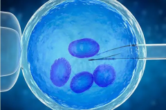 21号染色体多态性能否做三代试管？答案是肯定的