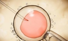 马来西亚供卵试管可以选择性别吗?服务价格高吗