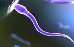 精子畸形是什么原因造成的?如何避免精子畸形率?