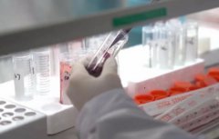 妊娠生化检查是什么？有什么目的？对胎儿有什么伤害？