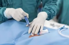 取卵手术费用一般多少钱?主要是哪方面收费高?