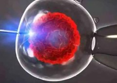 柬埔寨试管自己定男女需要多少钱?柬埔寨试管技术怎么样?