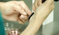 怎么样去格鲁吉亚做试管？首先要做一个全面的体检