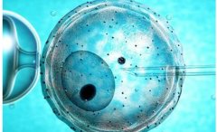 输卵管造影有什么作用？做三代试管一定要做输卵管造影