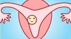 什么是内膜形态不好？如何治疗内膜健康？