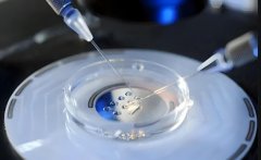 hcg是什么意思?hCG对照表对于试管移植有什么作用?