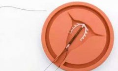 宫形环有什么用？有什么特别的寓意？