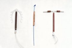 女性上环的类型有哪些?哪种的环比较不错?