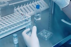 昆明做试管要准生证吗?试管还需要什么?