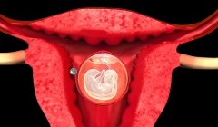 为什么试管移植着床失败?试管移植着床失败怎么办?