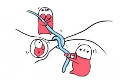 结扎了能做试管吗？有什么优势吗？