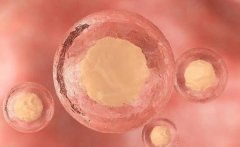 囊胚移植后肚子疼是什么原因造成的？如何预防？