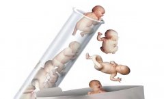 辅助生殖的类别及其特点分别是什么?如何选择辅助生殖医院?